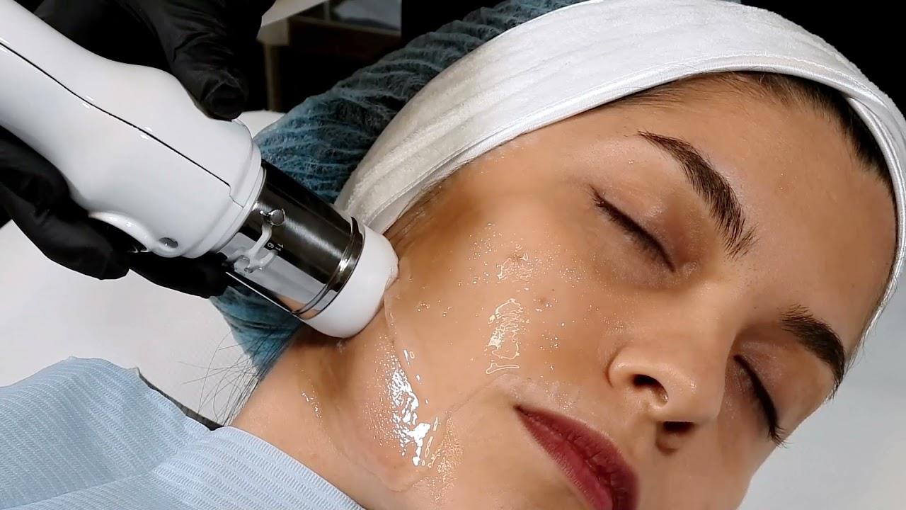 CFU - HIFU trắng sáng